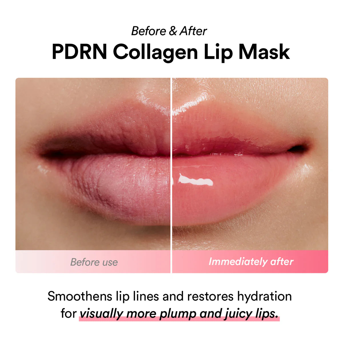 ABIB | PDRN Collagen Lip Mask Glazed Jelly 11g (Maschera Labbra)