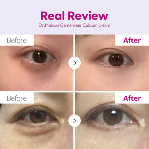 Dr. Melaxin | Cemenrete Calcium Dark Spot Eye Cream 15g (Crema contorno occhi)