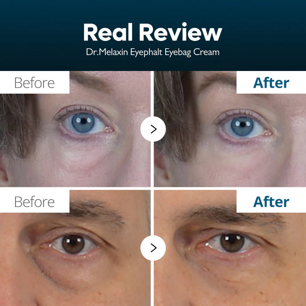 Dr. Melaxin | Eyephalt Eyebag Cream 10ml (Crema contorno occhi)