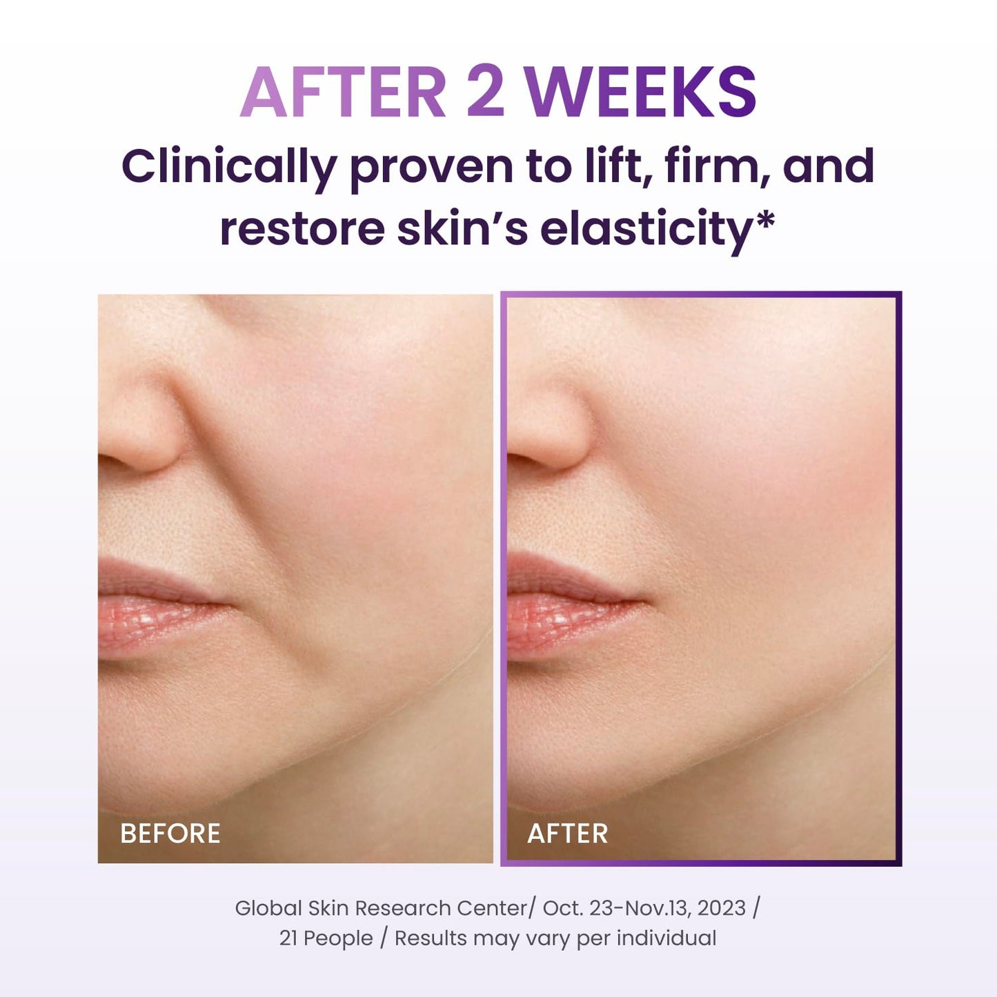 BIOHEAL BOH | Probioderm 3D Lifting Cream 50ml