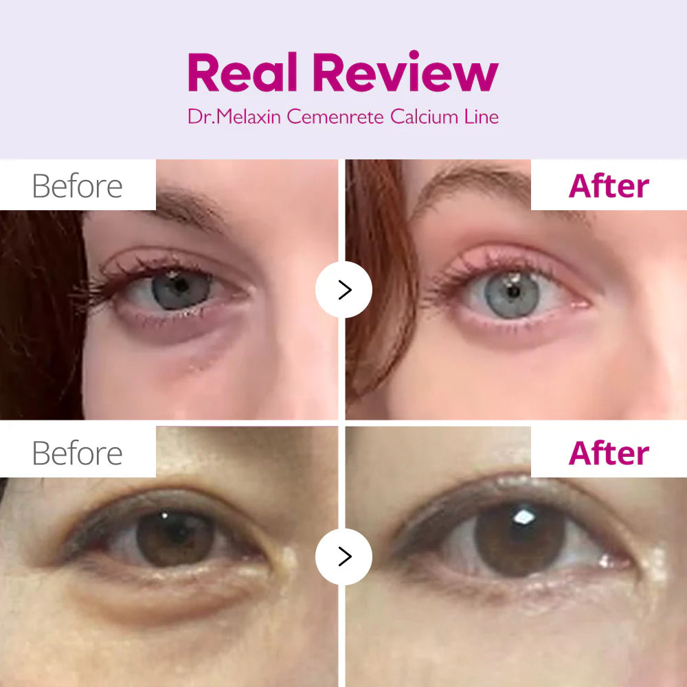 Dr. Melaxin | Cemenrete Calcium Dark Spot Eye Cream 15g (Crema contorno occhi)