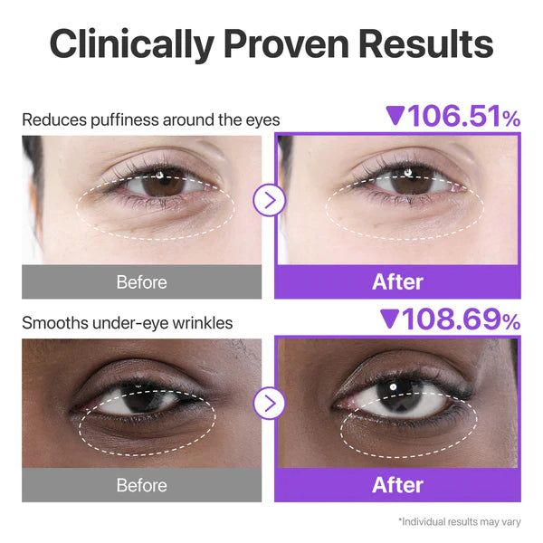 NUMBUZIN | No.9 NAD+ Collegen Under Eye Patches (5 paia)