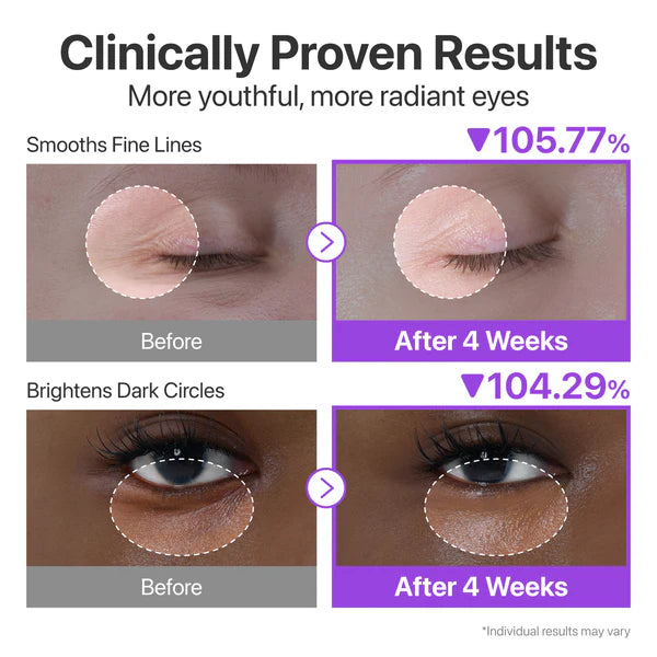 NUMBUZIN | No.9 NAD+ Retinol Volumetox Eye Cream 10ml (contorno occhi)