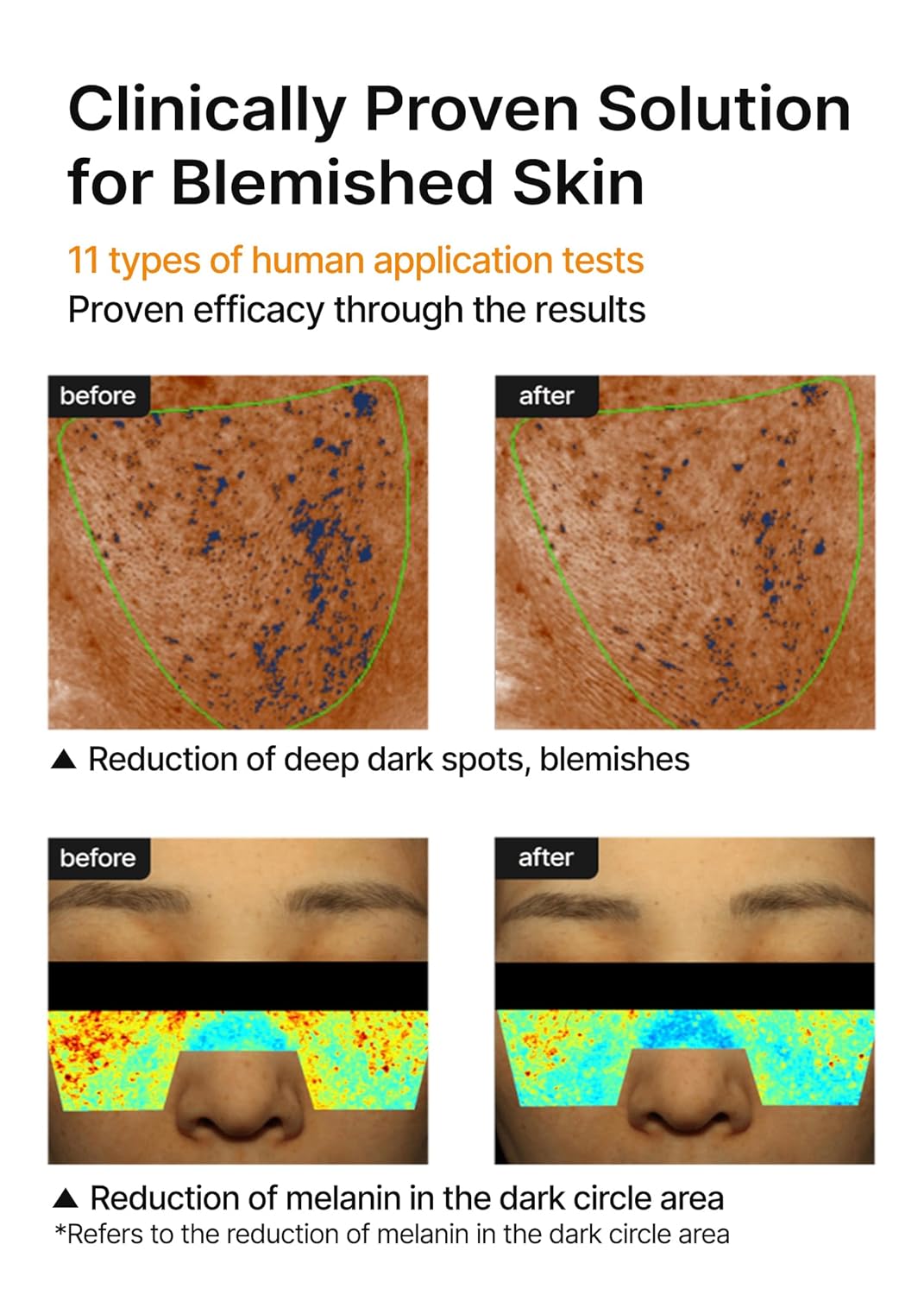 CELIMAX | Pore + Dark Spot Brightening Cream - 35ml