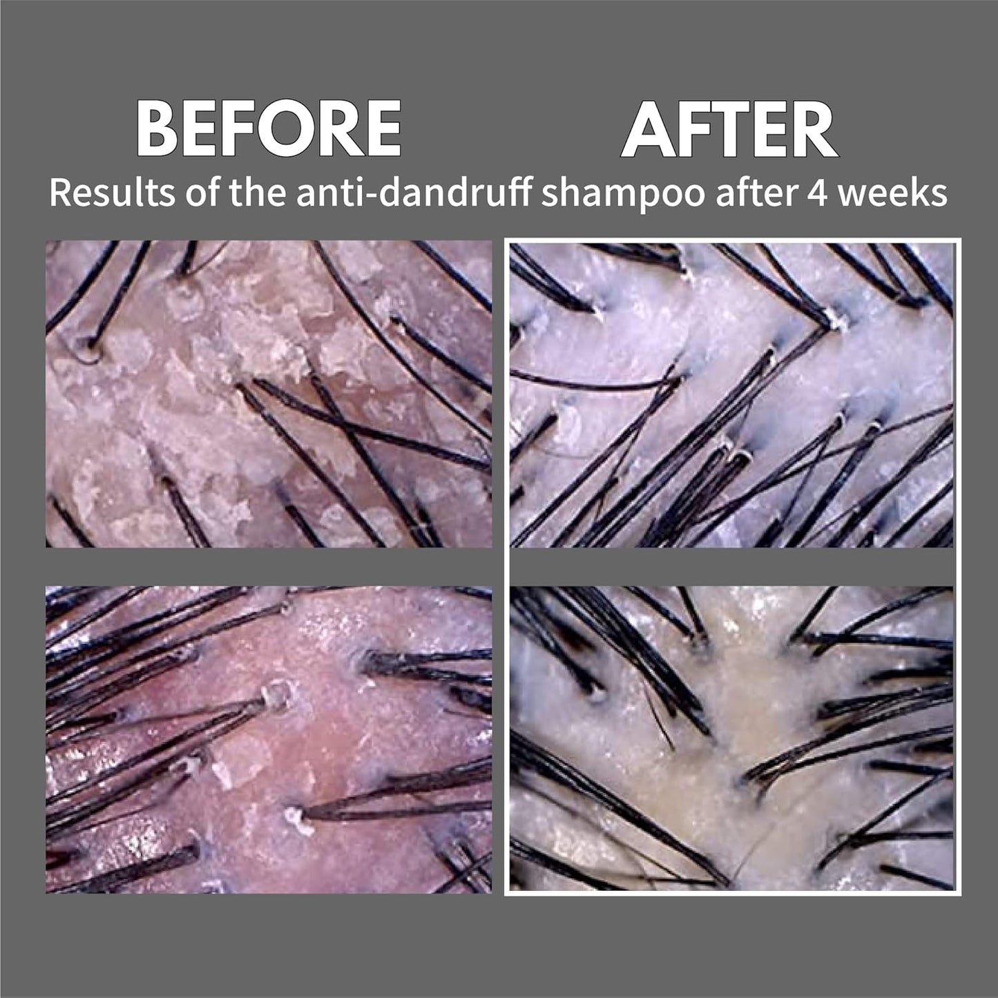 LADOR | Anti-Dandruff Shampoo 530ml