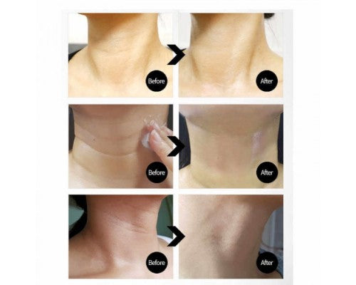 MEDI-PEEL | Premium Collagen Naite Thread Neck Cream 100ml (Crema collo)