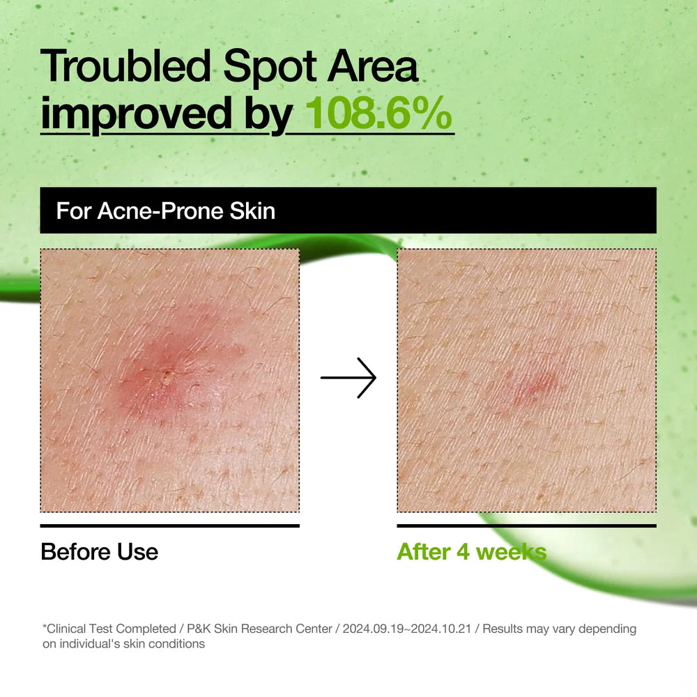 ANUA | Azelaic Acid 10 Hyaluron Redness Soothing Serum 30ml