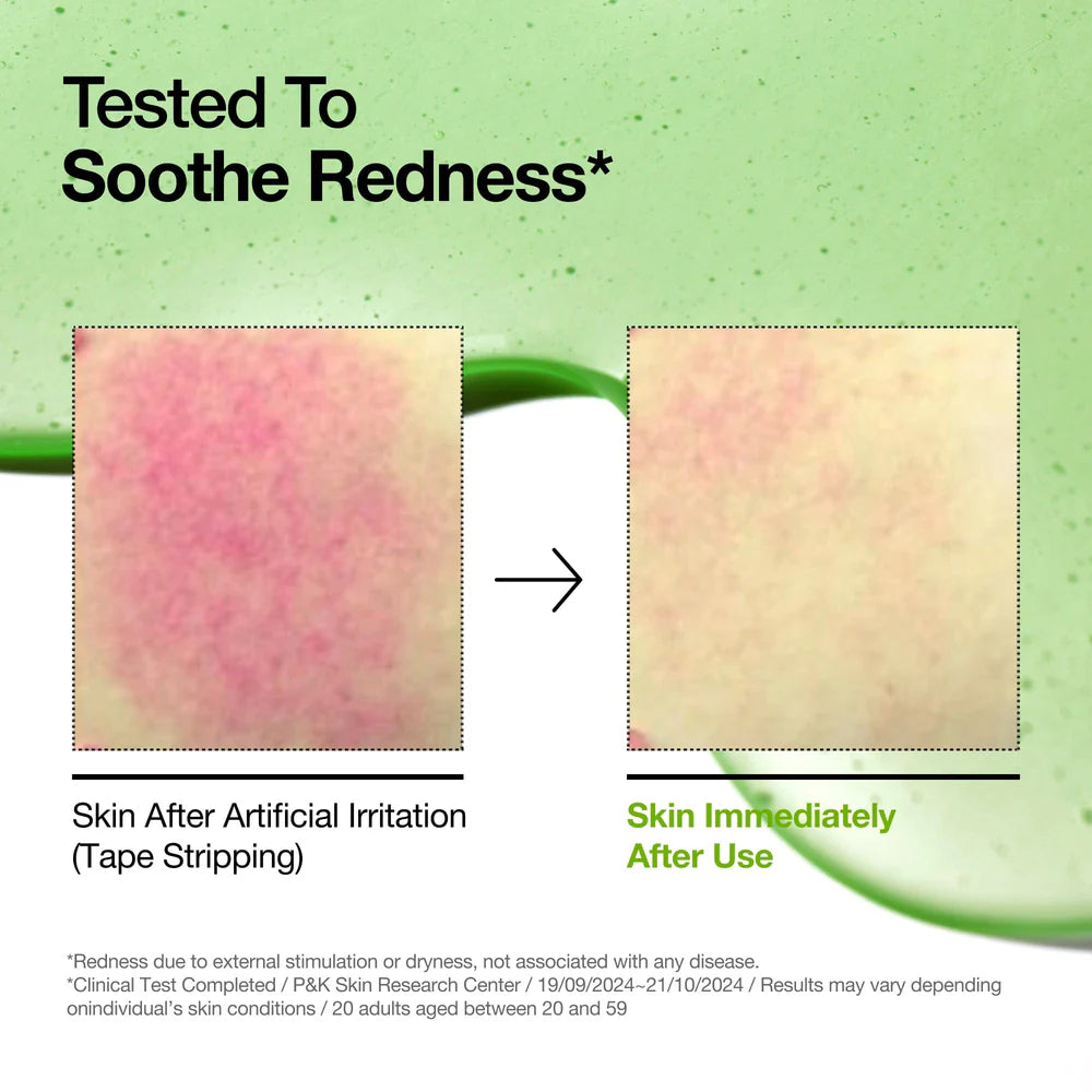 ANUA | Azelaic Acid 10 Hyaluron Redness Soothing Serum 30ml