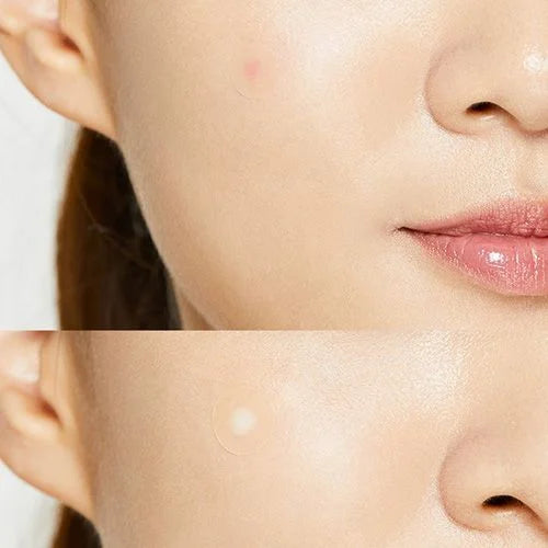 COSRX | Master Patch Original Fit 24pcs