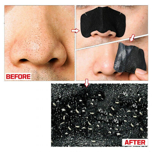 HOLIKA HOLIKA | Pig Clear Blackhead 3-step Kit (strong) (Cerottini punti neri)