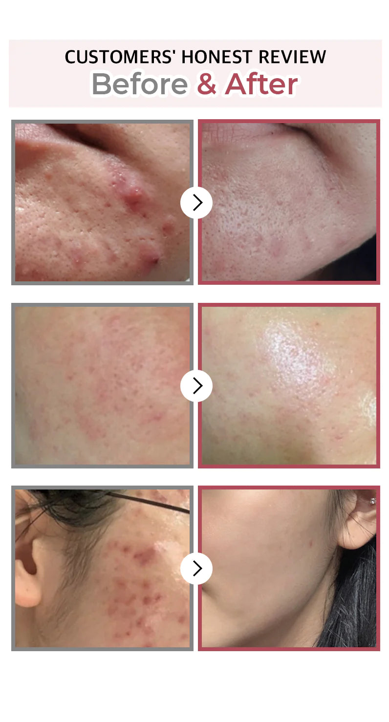 NUMBUZIN | No.3 Skin Softening Serum 50ml (Siero Viso)