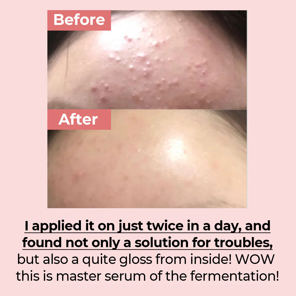 NUMBUZIN | No.3 Skin Softening Serum 50ml (Siero Viso)