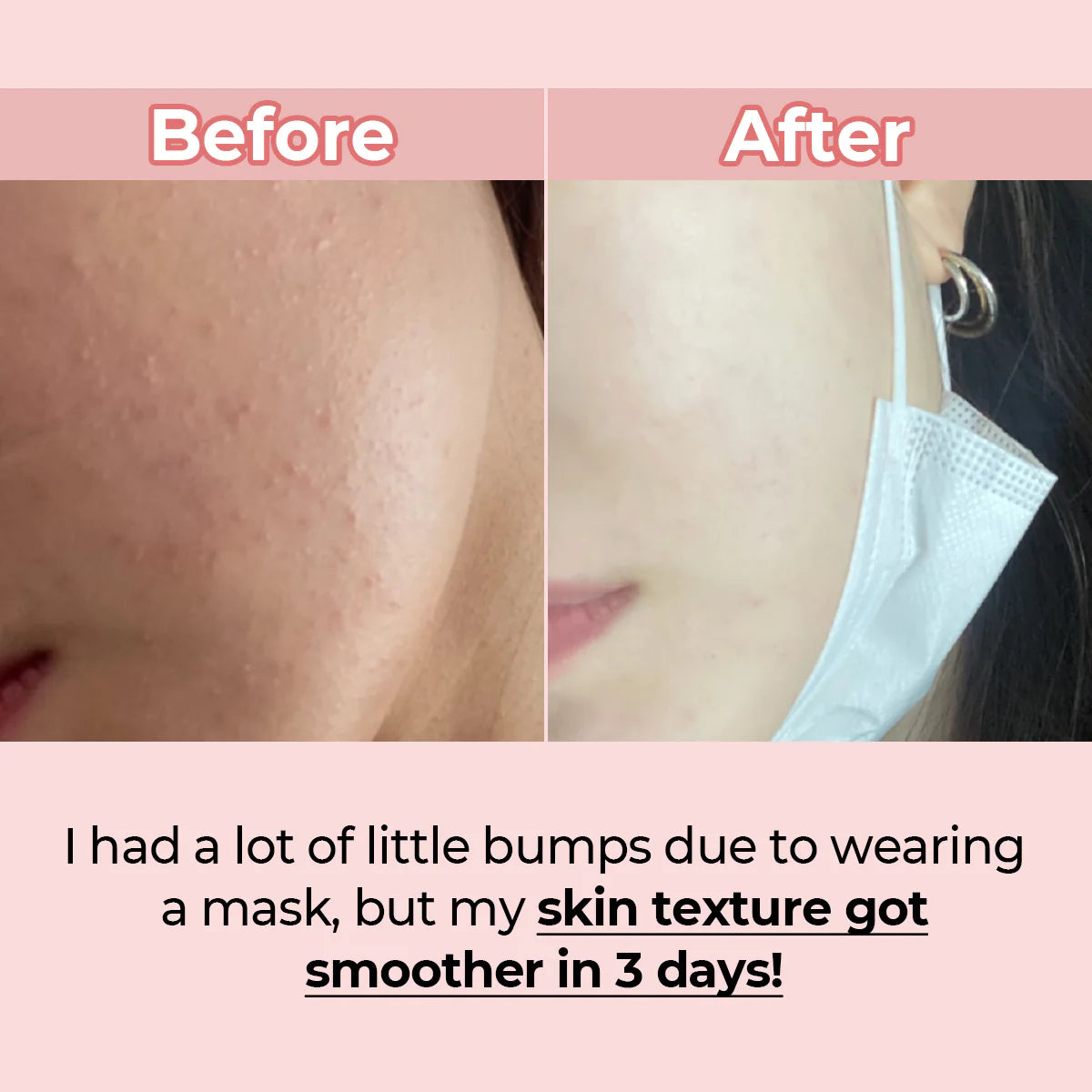 NUMBUZIN | No.3 Skin Softening Serum 50ml (Siero Viso)