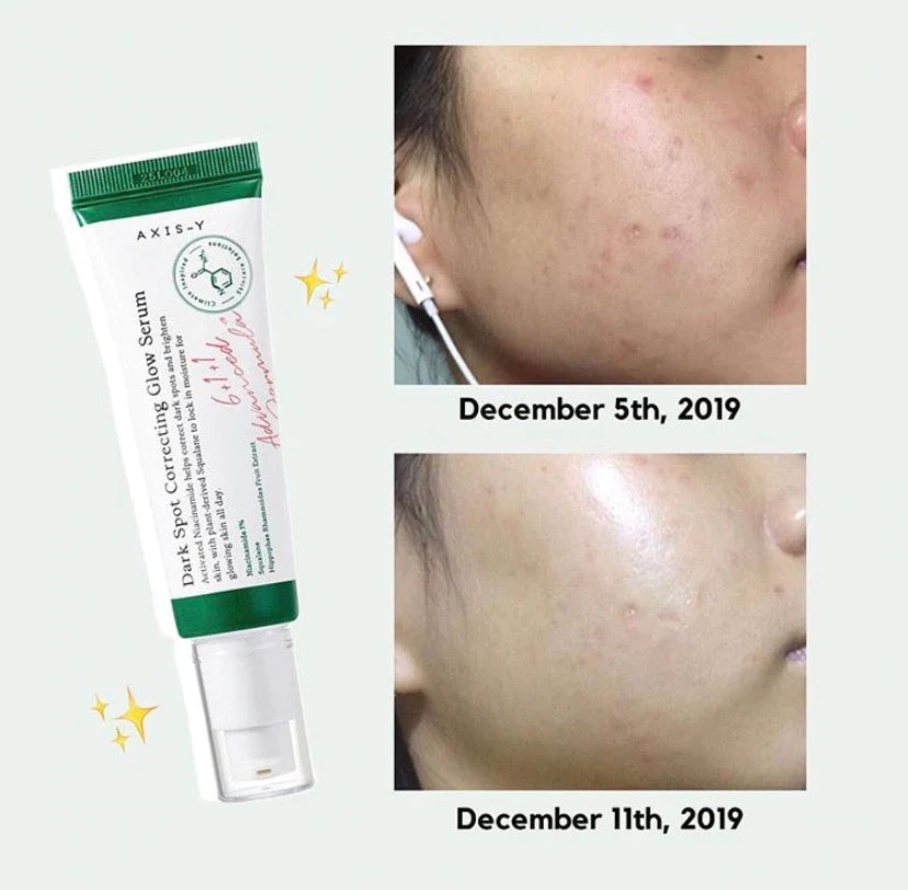 AXIS-Y | Dark Spot Correcting Glow Serum 50 ml (Siero Anti-macchie)