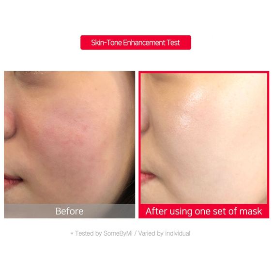 SOME BY MI | Tea Tree Calming Glow Luminous Ampoule Mask 25 G Maschera In Tessuto