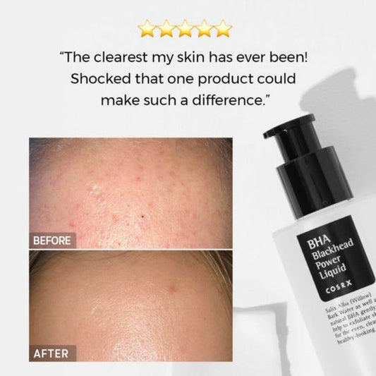 COSRX | BHA Blackhead Power Liquid 100 ml (Peeling Chimico)