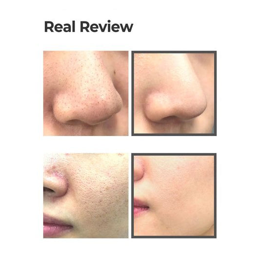 SOME BY MI | Charcoal BHA Pore Clay Bubble Mask 50ml