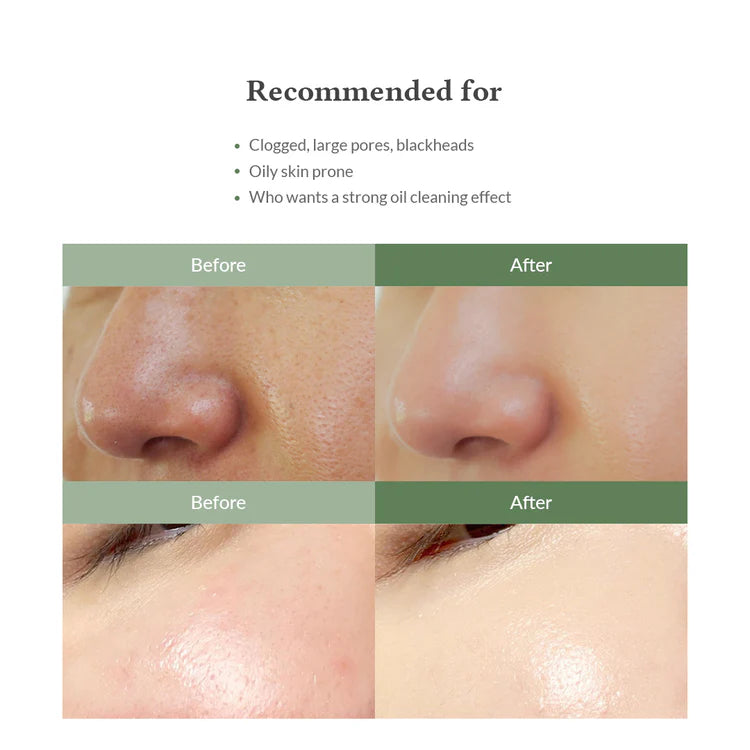 DR ALTHEA | Premium Quick Step Sebum Cleanser 100 ml (Trattamento punti neri)