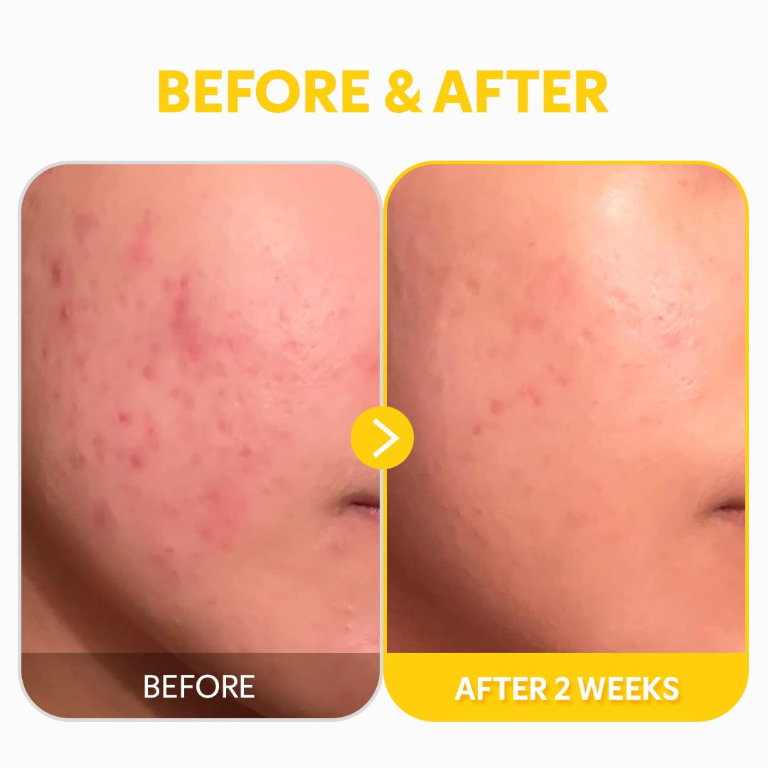 TIRTIR | Pure Vitamin C24 Serum - 30ml (Siero viso)