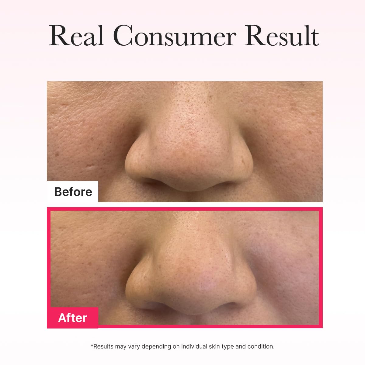 Arencia | Red Collagen Jello Mask 25g (Maschera viso)