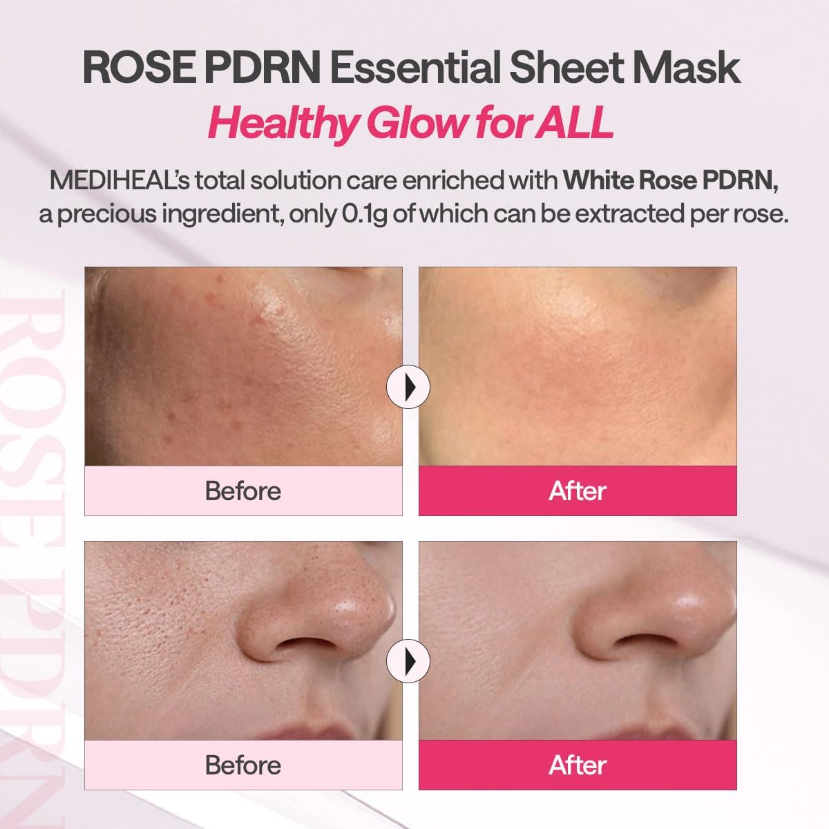 Mediheal | Rose PDRN Essential Mask Healthy Glow 24ml