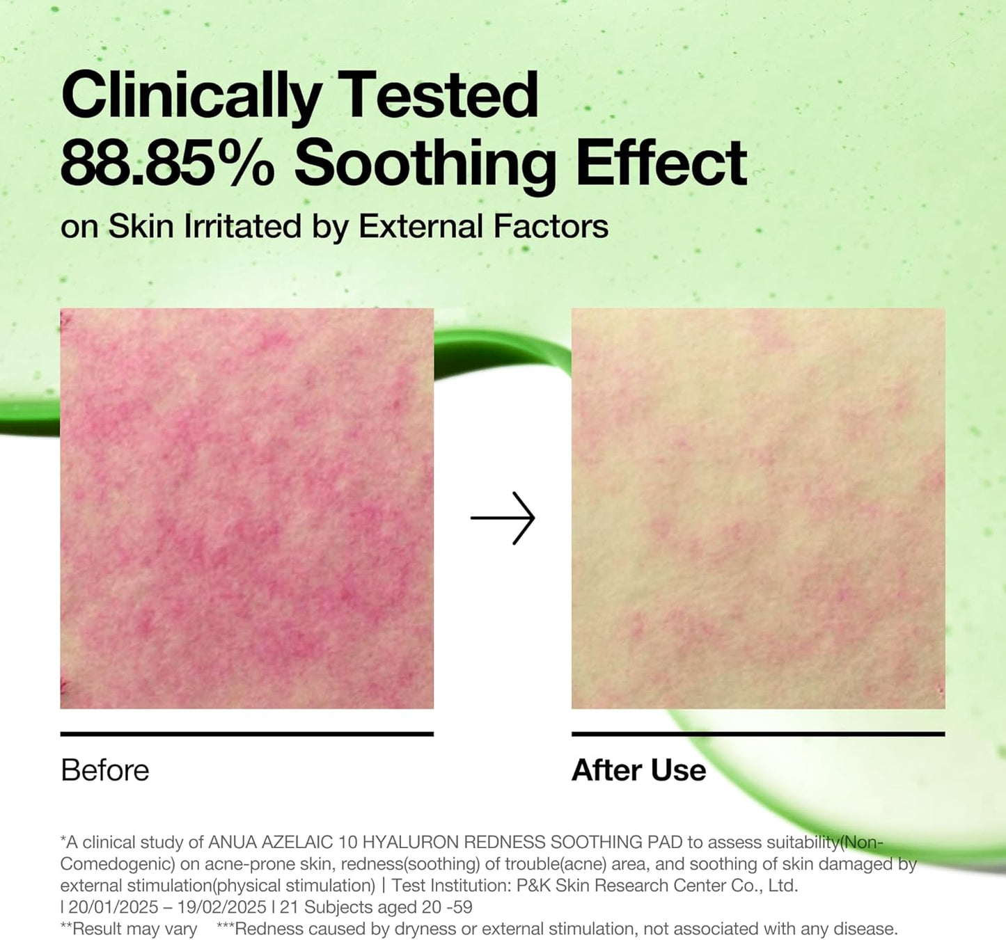 ANUA | Azelaic 10 Hyaluron Redness Soothing Pad 90 pads 230ml