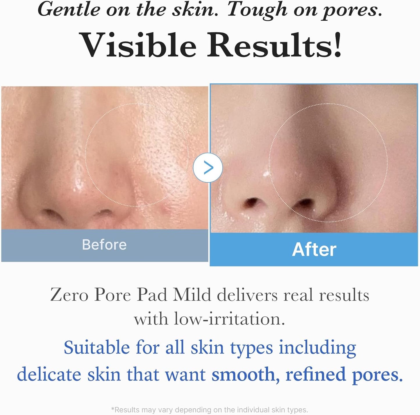 MEDICUBE | Zero Pore Pad Mild 70pcs 155g