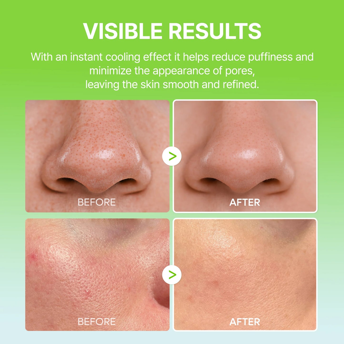 Dr.MELAXIN | CACTOX PORE RELIEF MULTI BALM 25g