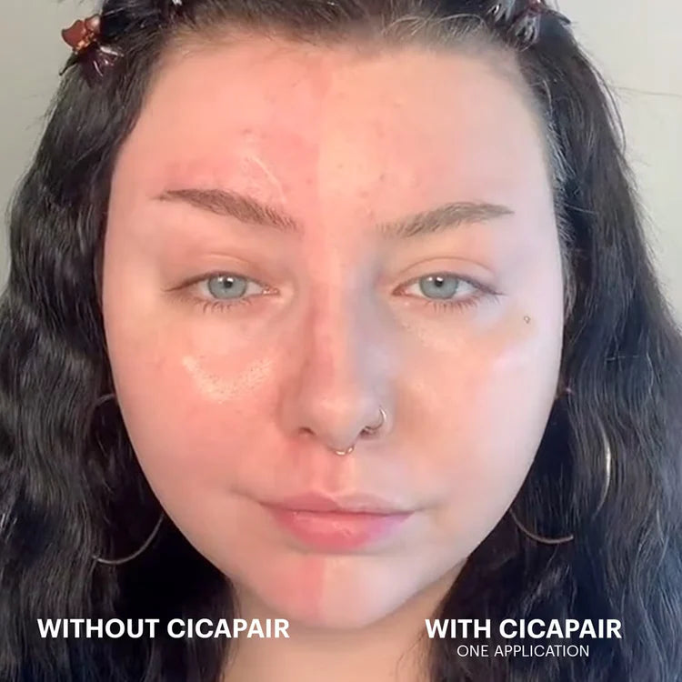 Dr. Jart+ | Cicapair Tiger Grass Color Correcting Treatment, 50ml