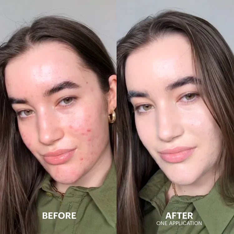 Dr. Jart+ | Cicapair Tiger Grass Color Correcting Treatment, 50ml