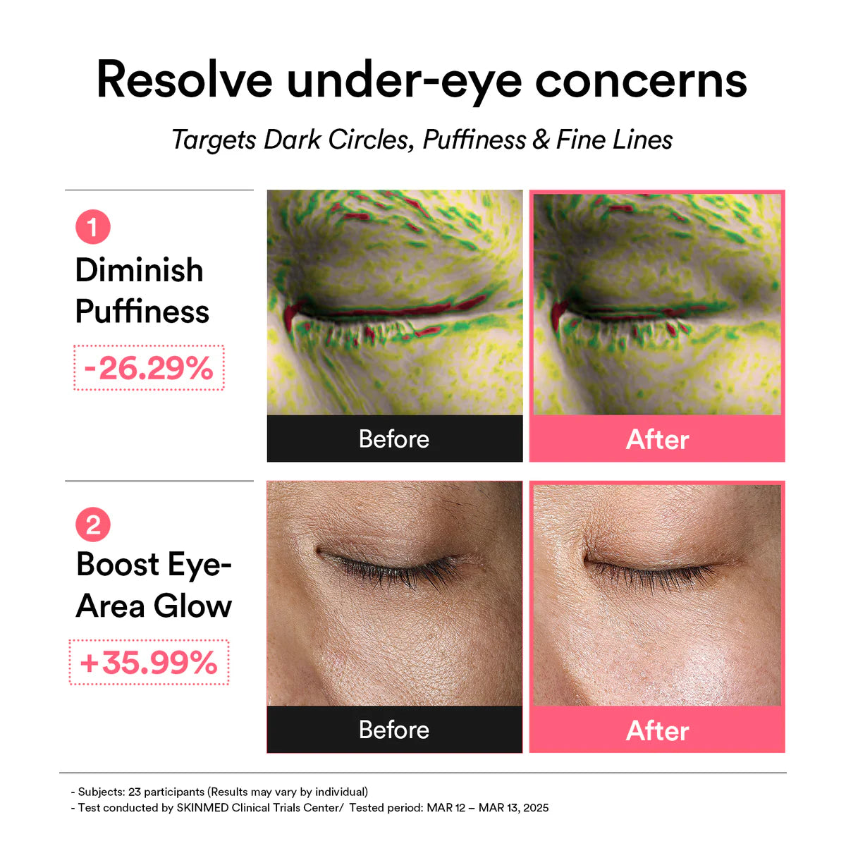 ABIB | PDRN Retinal Eye Patch Glow Jelly 60 pezzzi